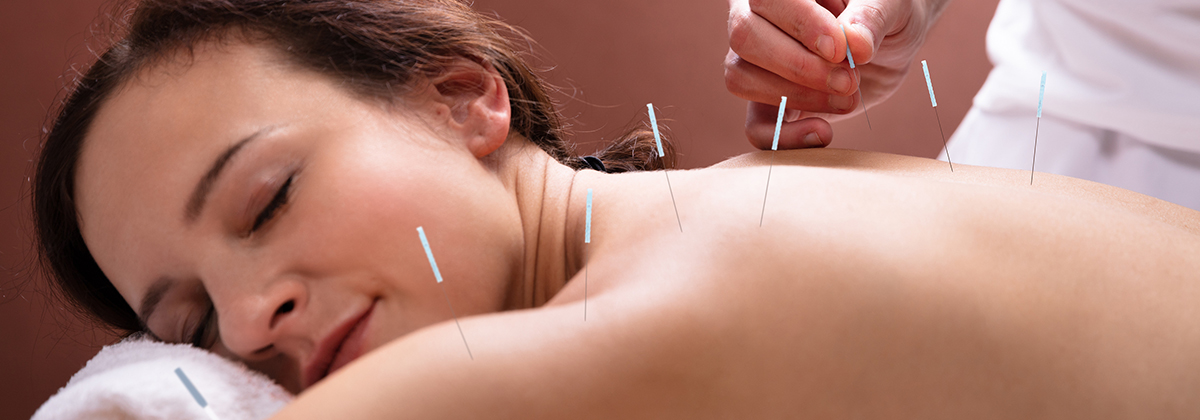 Close-up Of Relaxed Young Woman Going Through Acupuncture Treatment In Spa